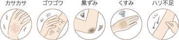 カサカサ ゴワゴワ 黒ずみ くすみ ハリ不足