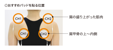◎おすすめパッドを貼る位置 肩の盛り上がった筋肉